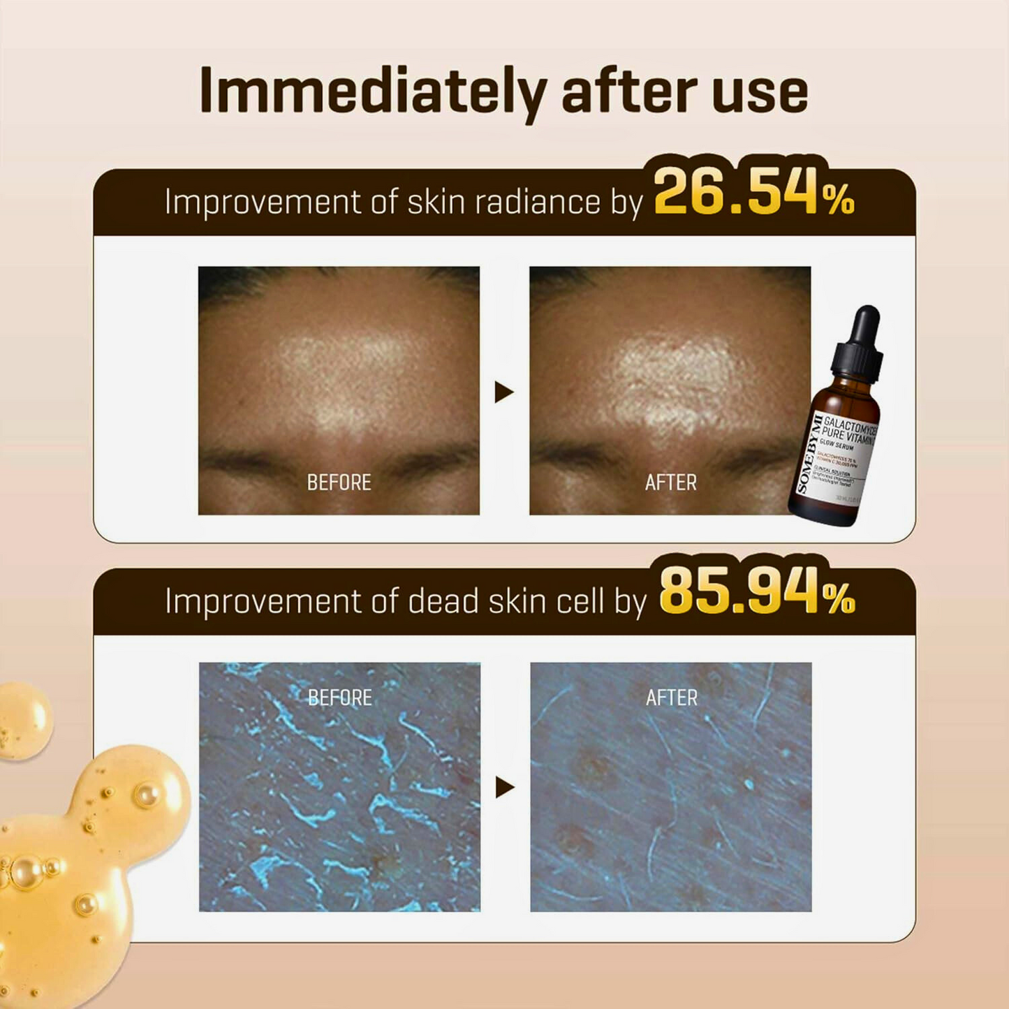 Some By Mi Galactomyces Pure Vitamin Glow Serum/30ml