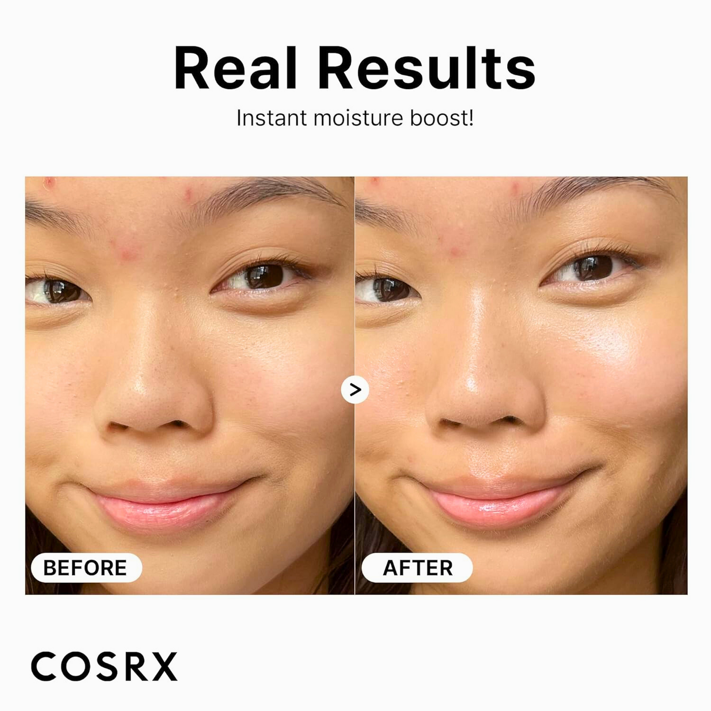COSRX The Hyaluronic Acid 3 Serum