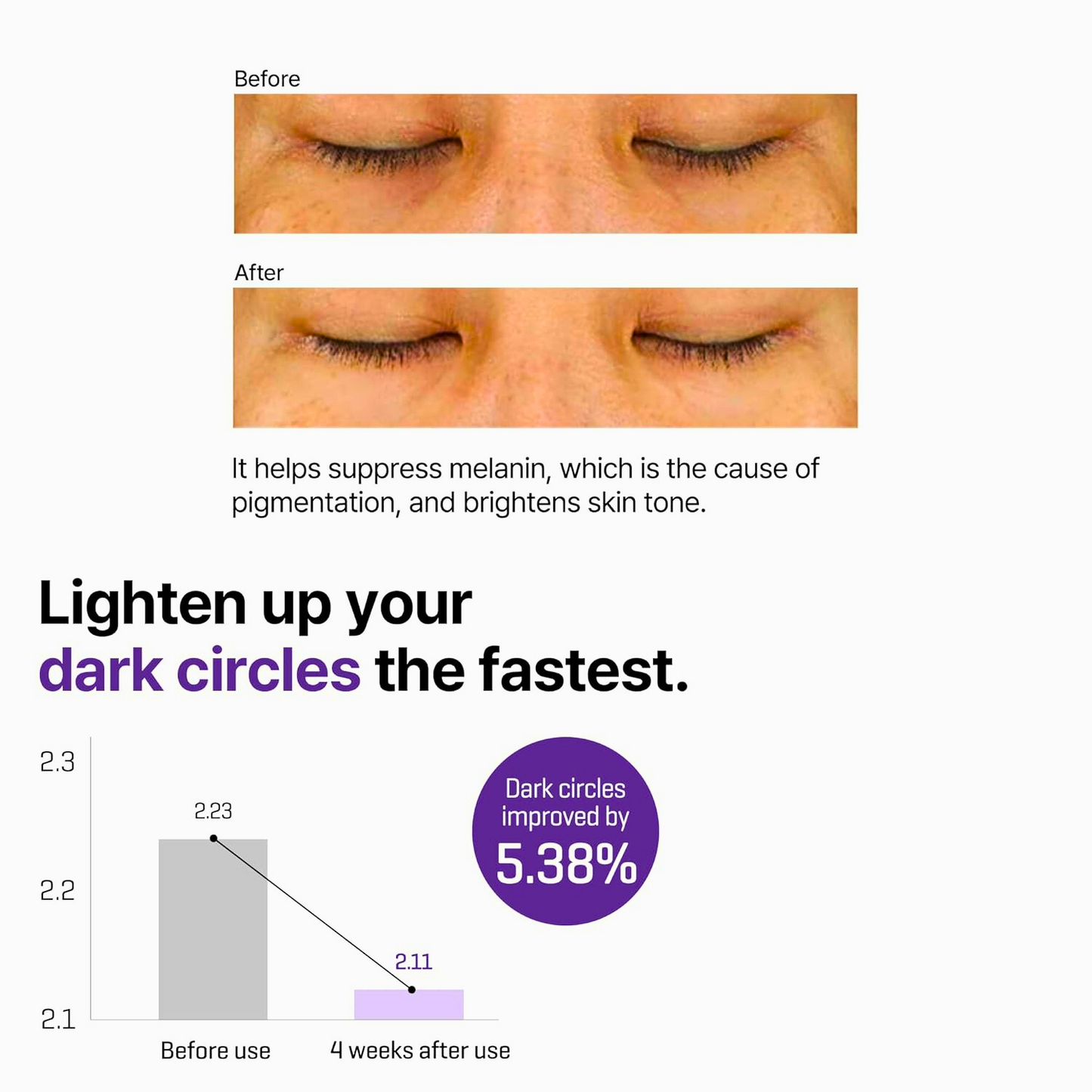 Some By MI Retinol Intense Advanced Triple Action Eye Cream, For Dark Circles and Fine Lines, 30ml