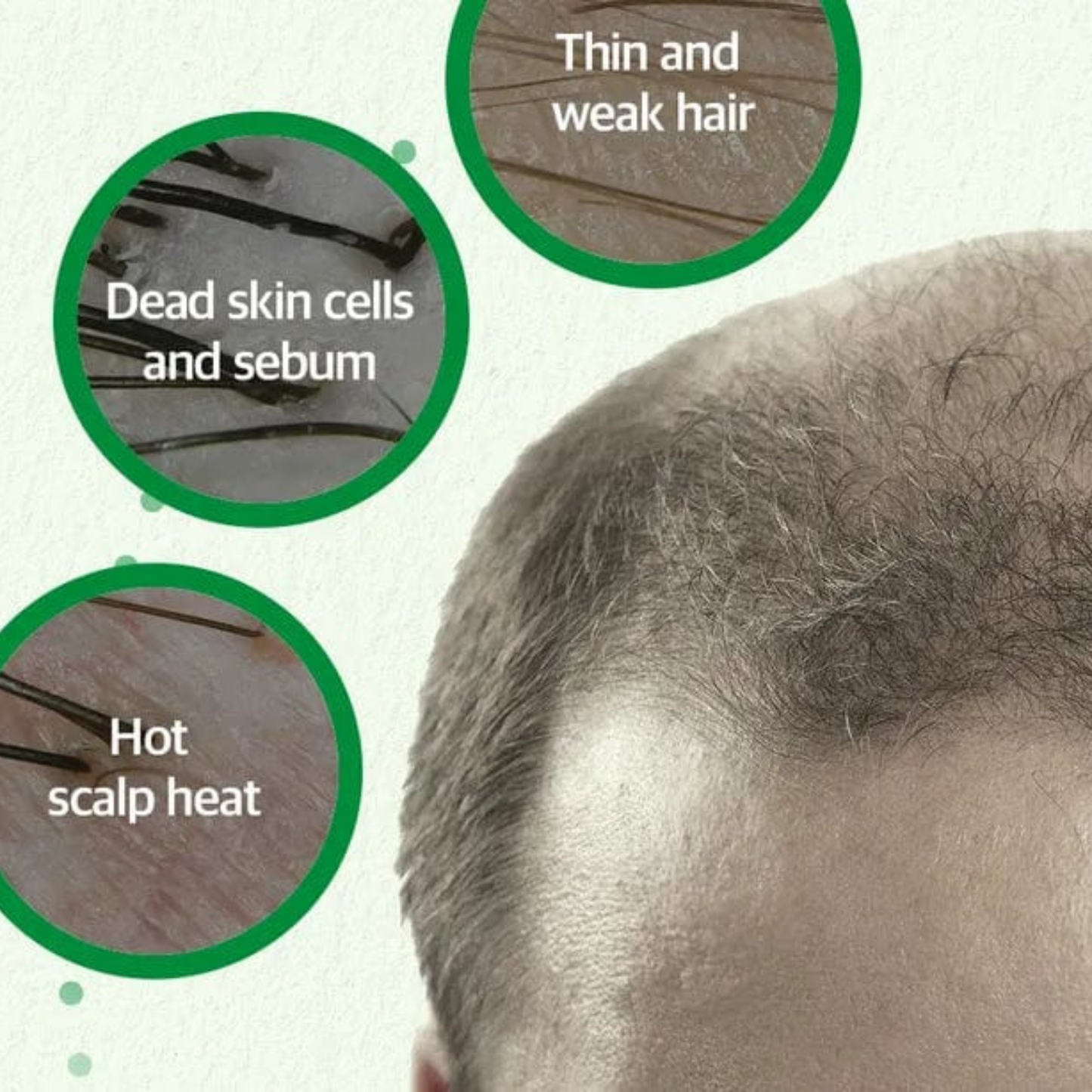 Some By Mi - Cica Peptide Anti Hair Loss Derma Scalp Tonic 150ml