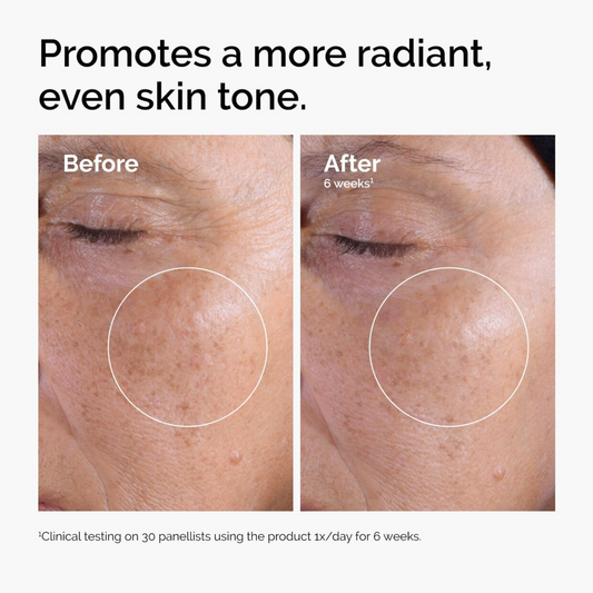 The Ordinary – Glycolic Acid 7% Exfoliating Toner 240ml